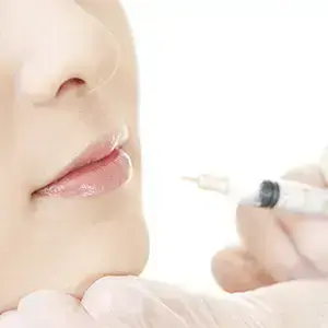 ボトックス治療